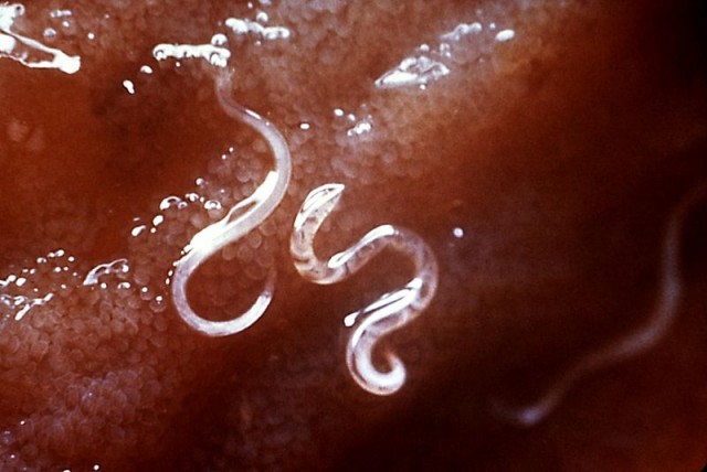 Hookworms similar to the type that afflicted ancient folks at Salmon Pueblo. Image source: CDC Public Health Image Library #5205.